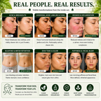 Before and after skin transformation results with visible improvements in various skin issues.