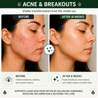 Before and after comparison of a woman's face with acne and breakouts, showing visible improvement after 8 weeks.
