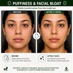 Before and after comparison of a woman's face with text about puffiness and facial bloat reduction.