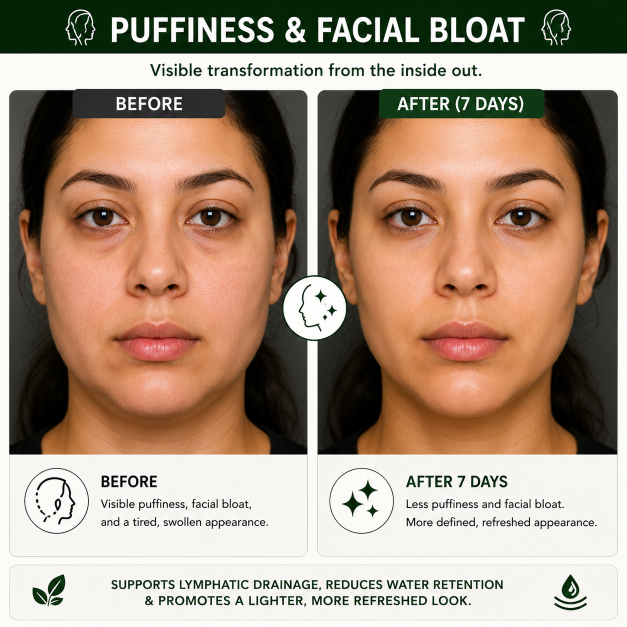 Before and after comparison of a woman's face with text about puffiness and facial bloat reduction.